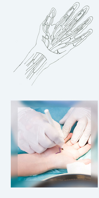 medical-lounge-handchirurgie